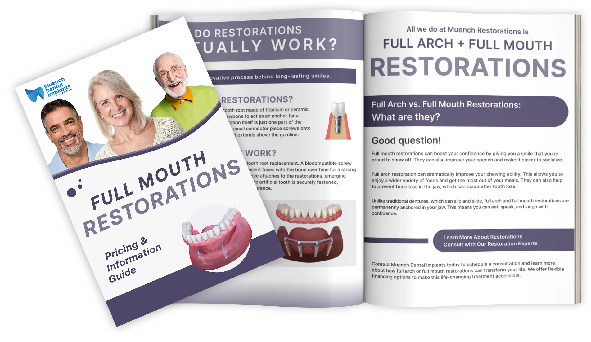 Full Mouth Restoration Book Guide